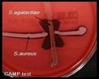 CAMP test